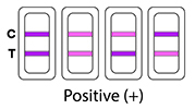 Positive HIV test result